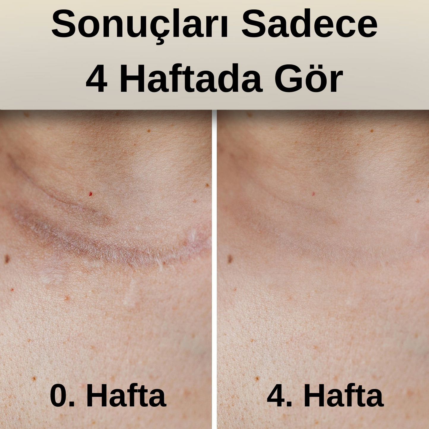 Haziel- Doğal Onarıcı Cilt Bakım Balmı